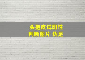 头孢皮试阳性判断图片 伪足